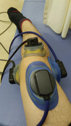 [実体験]前十字靭帯再建手術を受けて復帰するまで④[長い長いリハビリ]